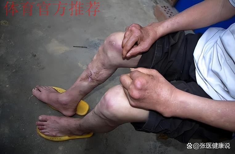 恐怖慎入!24岁加纳中场疑似断腿:小腿90度弯折变形 被担架抬走 恐怖慎入!24岁加纳中场疑似断腿:小腿90度弯折变形 被担架抬走